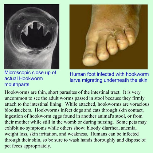 Hookworm Infections: Causes, Symptoms, and Treatments